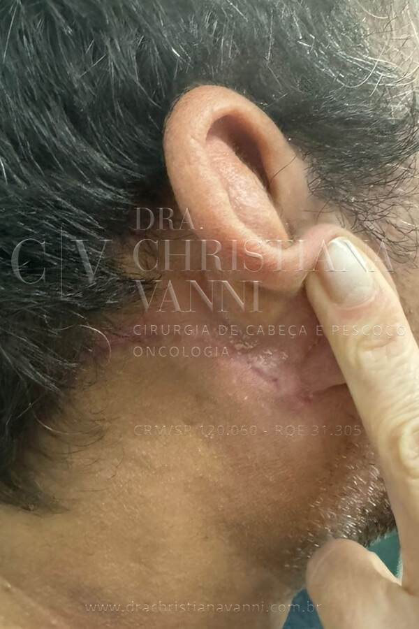 Médico de Cabeça e Pescoço