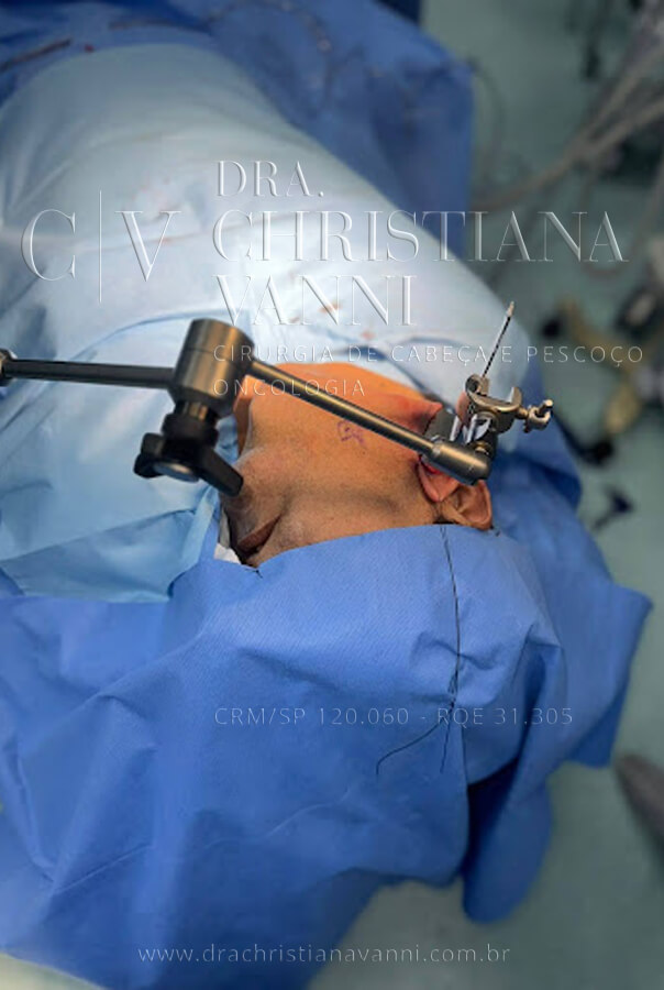 cirurgia robótica por acesso retroauricular