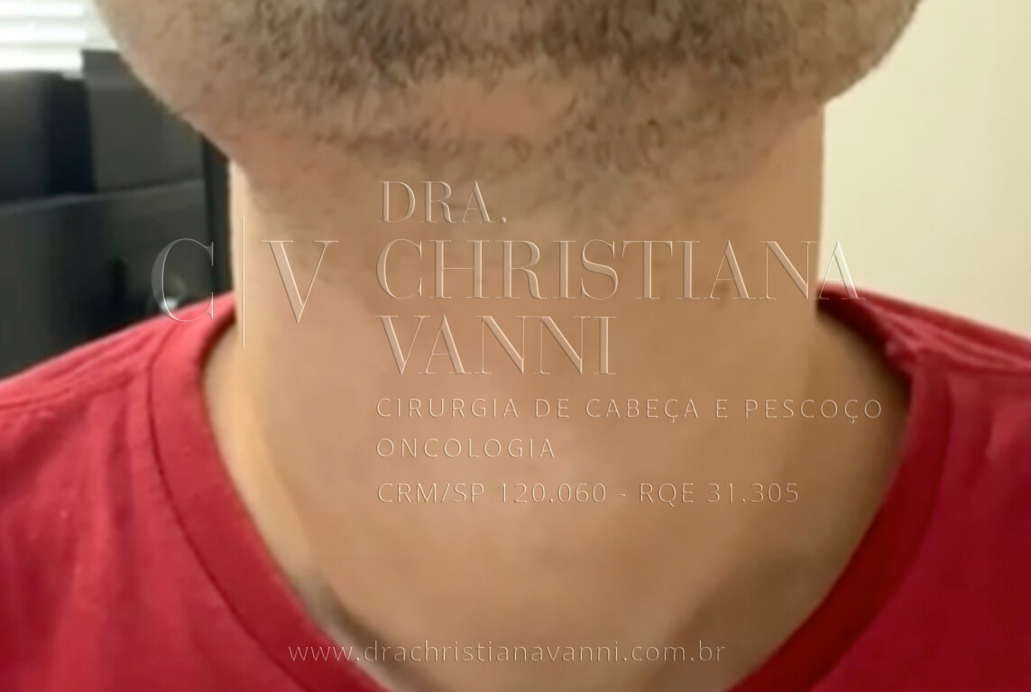 Foto de Bócio Grande
