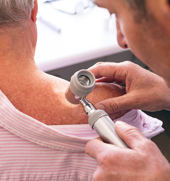 Tratamento Cirurgia de Câncer de Pele Oncologista Cirurgião SP