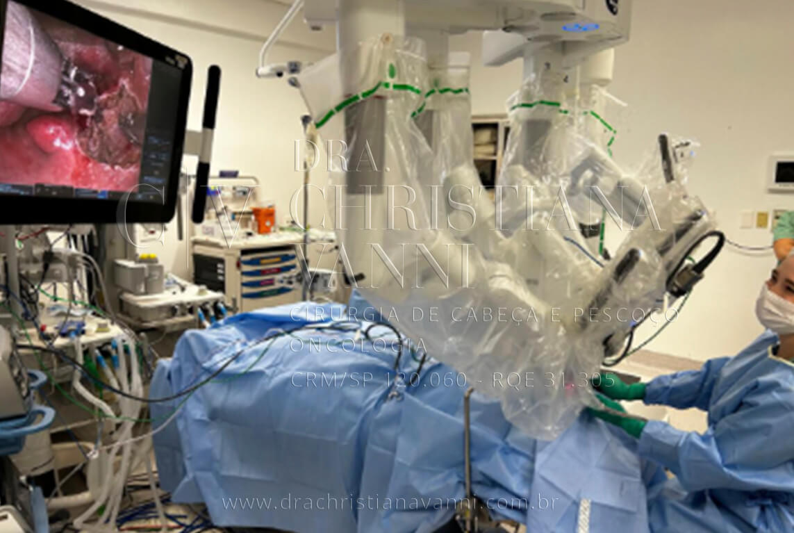 Cirurgia robótica de tireoid