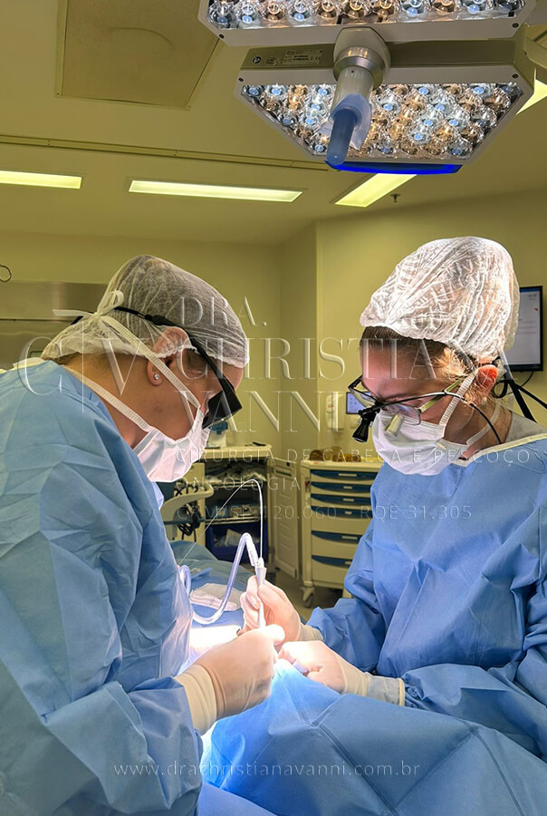 Cirurgia a laser verruga na língua