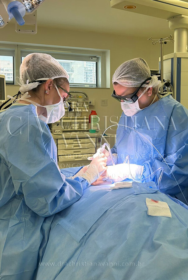 Cirurgia a laser verruga na língua